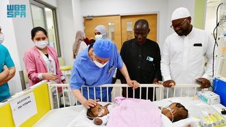 Surgery Begins For Nigerian Conjoined Twins