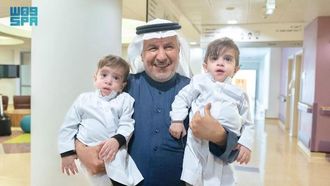 Successful Separation Of Twins Omar And Ali