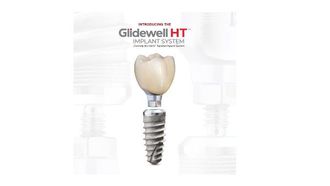 New Glidewell HT™ Implant Launch