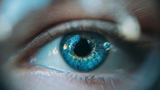 يشير الحول إلى مخاطر صحية أكبر