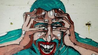 نموذج يظهر الدماغ في حالة الصرع