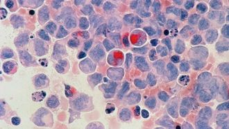 اختبار جديد يسرع الكشف عن السرطان