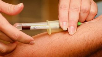 اختبارات الدم الحيوية للرؤى الصحية