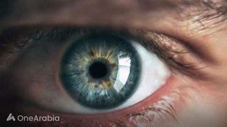 أسباب إعتام عدسة العين المبكر