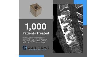 Curiteva Hits 1,000 Procedure Milestone