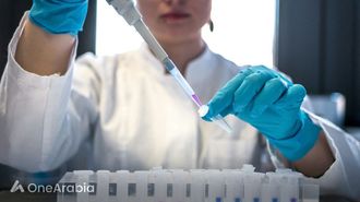 انتشار انفلونزا الطيور يثير قلق الخبراء