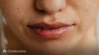 Minimize Barcode Lips For Youthful Smile