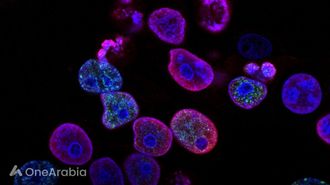 اختراق في بقاء سرطان الأمعاء