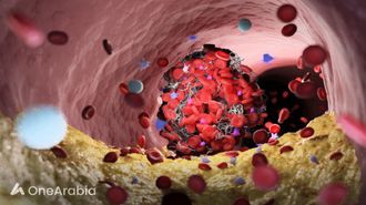 تعزيز صحة القلب بهذه الأطعمة