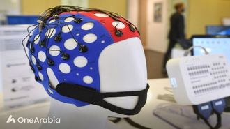 الذكاء الاصطناعي يكتشف مرض التوحد بدقة عالية