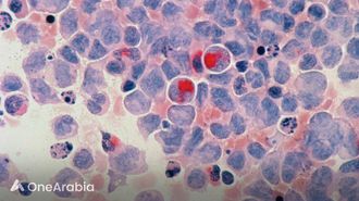 تطوير لقاح سرطان الكبد