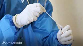 الإفراط في تشخيص كوفيد الطويل؟