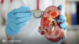 MTX-531: التغلب على مقاومة السرطان