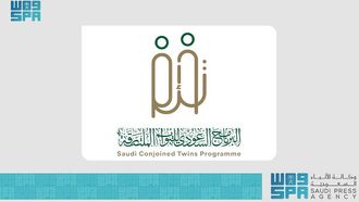 Saudi's 30-Year Milestone In Twins Separation