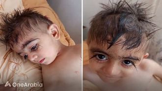 رموش طويلة للأطفال تدهش الويب