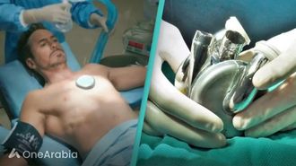 مريض أمريكي يحصل على قلب من التيتانيوم