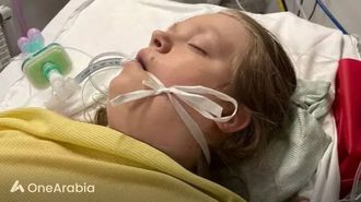 انقطاع دعم ما قبل الحياة عن تعافي المرأة المعجزة