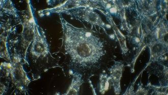 كيف تهرب الأورام من المناعة