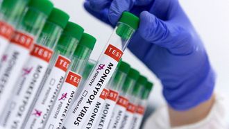 Mpox Alert Enhanced In Italy, Korea