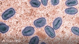 جدري القرود أصبح الآن حالة طوارئ صحية عالمية