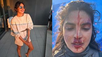 Truth Behind Priyanka's Injury Photos