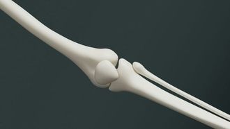 أسباب طقطقة المفاصل