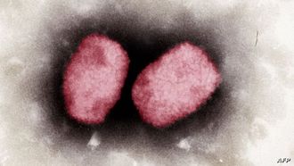 رؤى حول انتقال مرض جدري القرود والوقاية منه