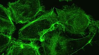 تحديد أصل سرطان المبيض القاتل