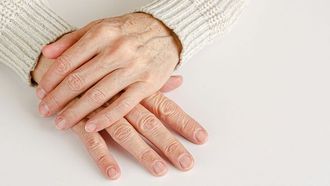 الخلايا الزومبي في الجلد قد تؤثر على الشيخوخة