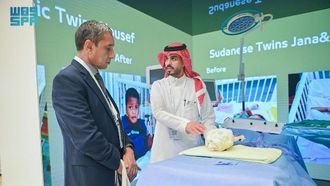 معرض ناجح في مؤتمر التوائم الملتصقة