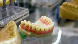 المخاطر الصحية الخطيرة لتسوس الأسنان