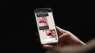 Aster Clinics Unveils Smyl AI For Dental Care