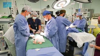 نجاح عملية فصل توأم سوري ملتصق