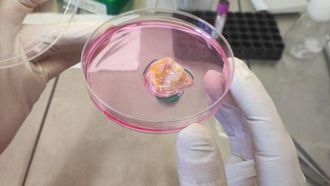 New Cancer Therapy Launched In Abu Dhabi