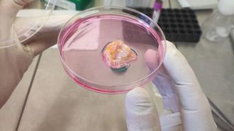 إطلاق برنامج جديد لعلاج السرطان في الإمارات العربية المتحدة