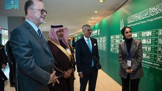 معرض يسلط الضوء على جهود المملكة العربية السعودية في مجال التوائم الملتصقة