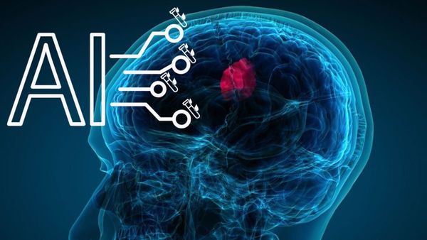 AI Advances in Brain Tumor Care