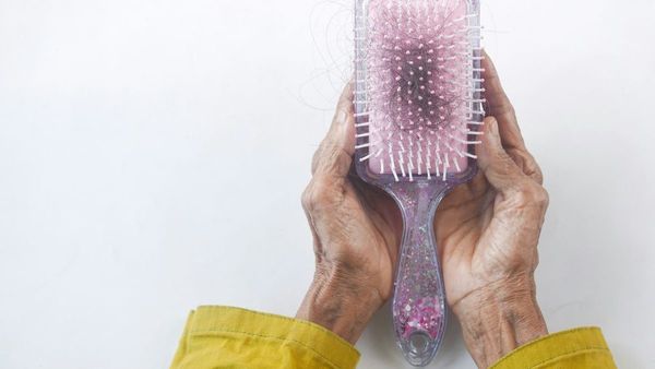 UAE Hair Loss  Myths and Solutions