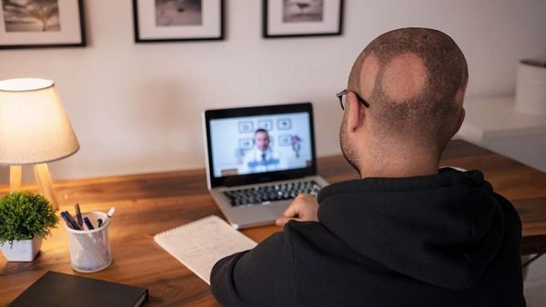 Pfizer s Alopecia Solution in UAE