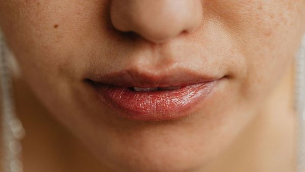Minimize Barcode Lips for Youthful Smile