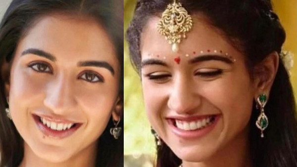 Radhika's Pre-Wedding Dental Makeover Radhika's Pre-Wedding Dental Makeover