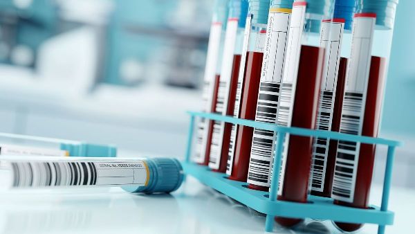 New Liquid Biopsy Test for Colorectal Cancer in Abu Dhabi New Liquid Biopsy Test for Colorectal Cancer in Abu Dhabi