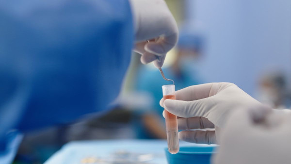 Testicular Cryopreservation Success at ADSCC Testicular Cryopreservation Success at ADSCC